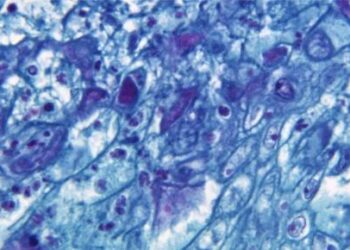 Viruela del mono, aborto, derechos humanos en Venezuela… Las noticias del miércoles