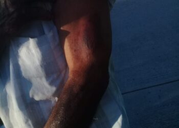 Trabajador municipal de Atzompa ataca a un adulto mayor